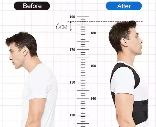 The Posture Corrector